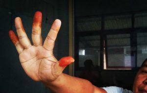 Pakai Inai di Tiga Jari, Tradisi Warga Neuhen Tolak Bala