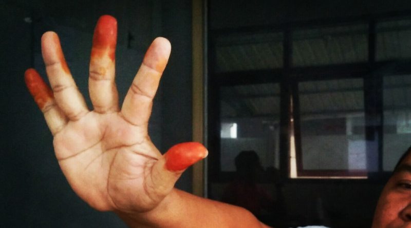 Pakai Inai Di Tiga Jari Tradisi Warga Neuhen Tolak Bala Halaman 7