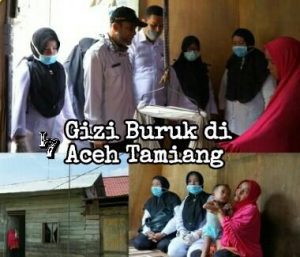 Sejumlah Balita di Aceh Tamiang Alami Gizi Buruk