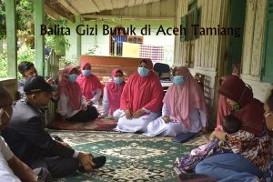 Dua Lagi Balita Gizi Buruk Ditemukan di Aceh Tamiang