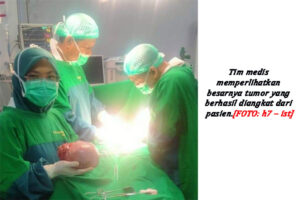 RSUD Kutacane Selamatkan Penderita Tumor Padat