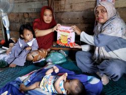 Dinkes Agara Bantu Bayi Lahir Tanpa Cangkang